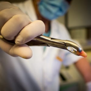 Dental treatment explained