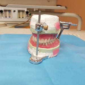 Dentures