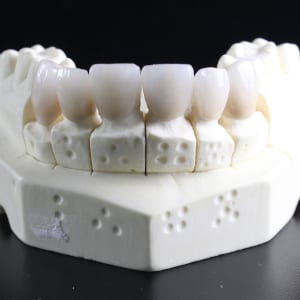 What is a dental crown?