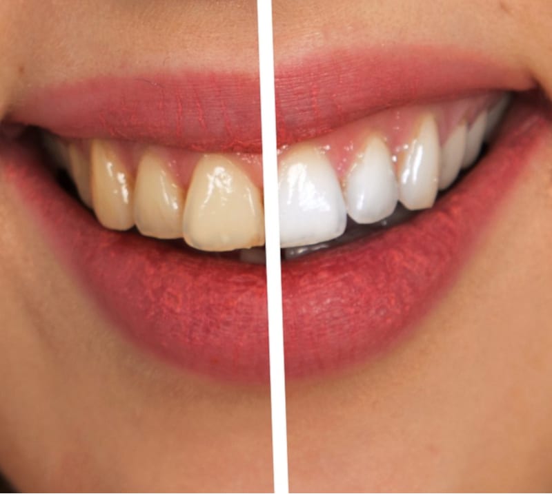 Dental treatment in Poland Dentists in Poland Save up to 70